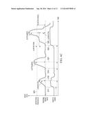 EPILEPTIC EVENT DETECTION BASED ON CORRELATION OF BODY SIGNALS diagram and image