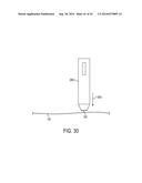 Methods of Manufacture to Optimize Performance of Transdermal Sampling and     Analysis Device diagram and image