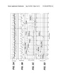 SYSTEMS AND METHODS TO DETERMINE HR, RR AND CLASSIFY CARDIAC RHYTHMS BASED     ON ATRIAL IEGM AND ATRIAL PRESSURE SIGNALS diagram and image