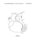 Devices and Methods for Catheter Localization diagram and image