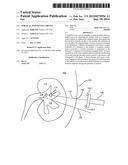 SURGICAL POSITIONING CIRCUIT diagram and image