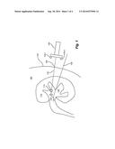 SURGICAL POSITIONING CIRCUIT diagram and image