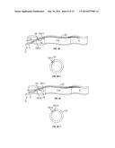 Side Lumen Reentry Catheters And Related Methods diagram and image