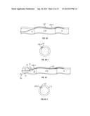 Side Lumen Reentry Catheters And Related Methods diagram and image