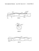 Side Lumen Reentry Catheters And Related Methods diagram and image