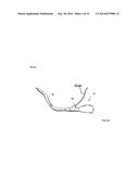 TISSUE IMAGING AND IMAGE GUIDANCE IN LUMINAL ANATOMIC STRUCTURES AND BODY     CAVITIES diagram and image