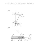 TISSUE IMAGING AND IMAGE GUIDANCE IN LUMINAL ANATOMIC STRUCTURES AND BODY     CAVITIES diagram and image