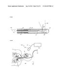 TISSUE IMAGING AND IMAGE GUIDANCE IN LUMINAL ANATOMIC STRUCTURES AND BODY     CAVITIES diagram and image