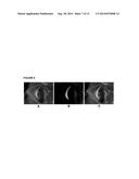 IMAGING SYSTEM AND METHOD FOR FLUORESCENCE GUIDED SURGERY diagram and image