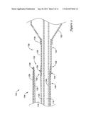 CATHETER SHAFT CONSTRUCTIONS HAVING CONTRAST FLUID LUMEN diagram and image