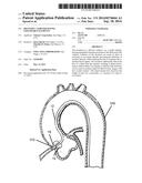 DELIVERY CATHETER HAVING EXPANDABLE ELEMENTS diagram and image