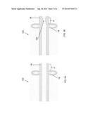 DELIVERY CATHETER HAVING EXPANDABLE ELEMENTS diagram and image