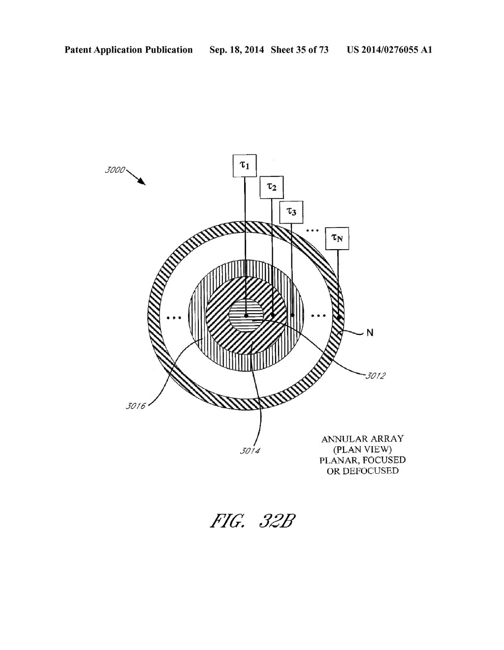 REFLECTIVE ULTRASOUND TECHNOLOGY FOR DERMATOLOGICAL TREATMENTS - diagram, schematic, and image 36