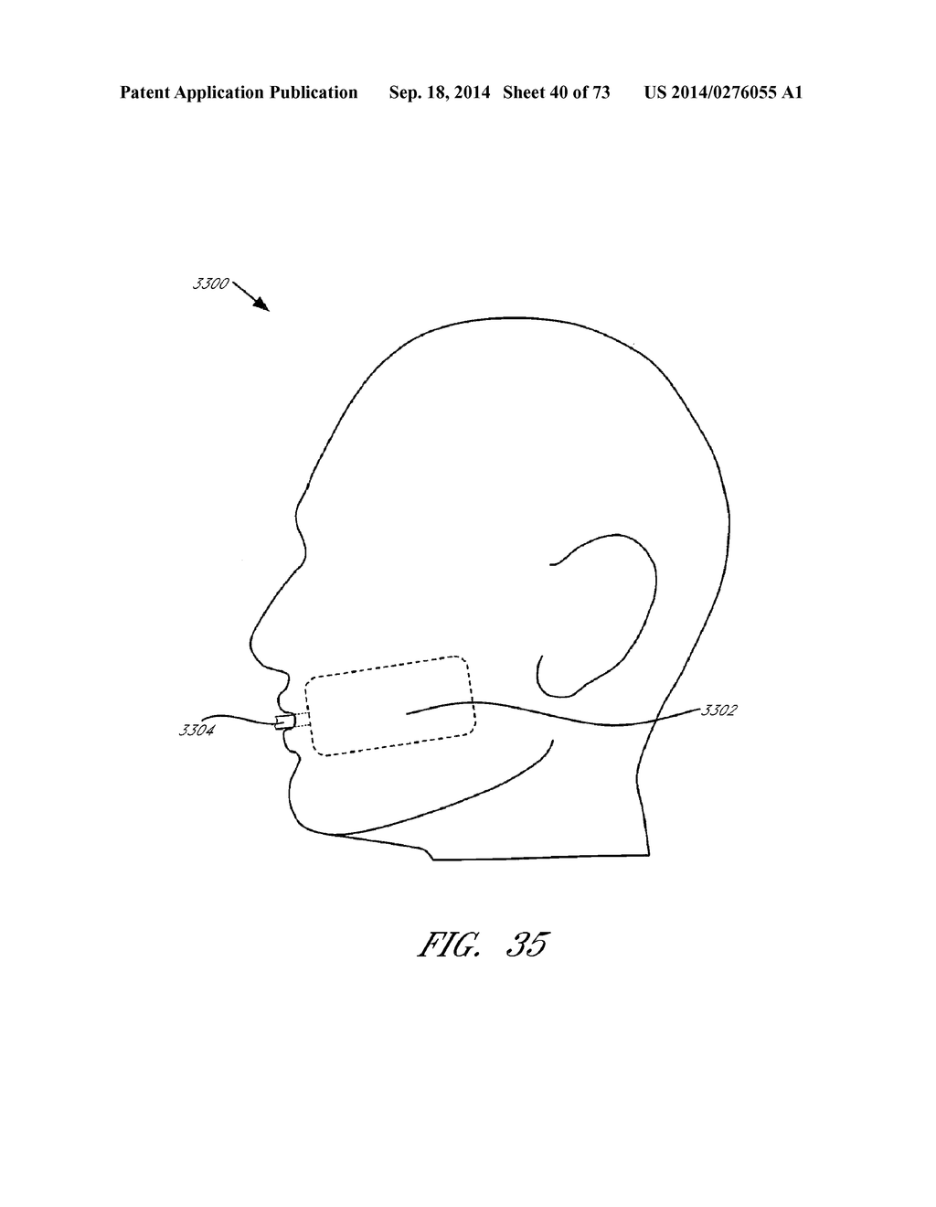 REFLECTIVE ULTRASOUND TECHNOLOGY FOR DERMATOLOGICAL TREATMENTS - diagram, schematic, and image 41