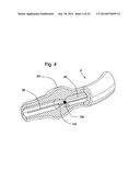 EXTERNALLY IMAGING A BODY STRUCTURE WITHIN A PATIENT diagram and image