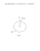 EXTERNALLY IMAGING A BODY STRUCTURE WITHIN A PATIENT diagram and image