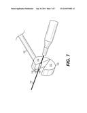 ULTRASOUND TRANSDUCER WITH NEEDLE CHANNEL diagram and image