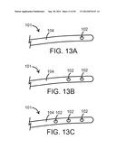 IMPEDANCE DEVICES AND METHODS OF USING THE SAME IN CONNECTION WITH A     MAMMALIAN VASCULATURE diagram and image