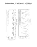 NON-INVASIVE METHOD AND DEVICE OF MEASURING THE REAL-TIME CONTINUOUS     PRESSURE OF FLUID IN ELASTIC TUBE AND THE DYNAMIC COMPLIANCE OF ELASTIC     TUBE diagram and image