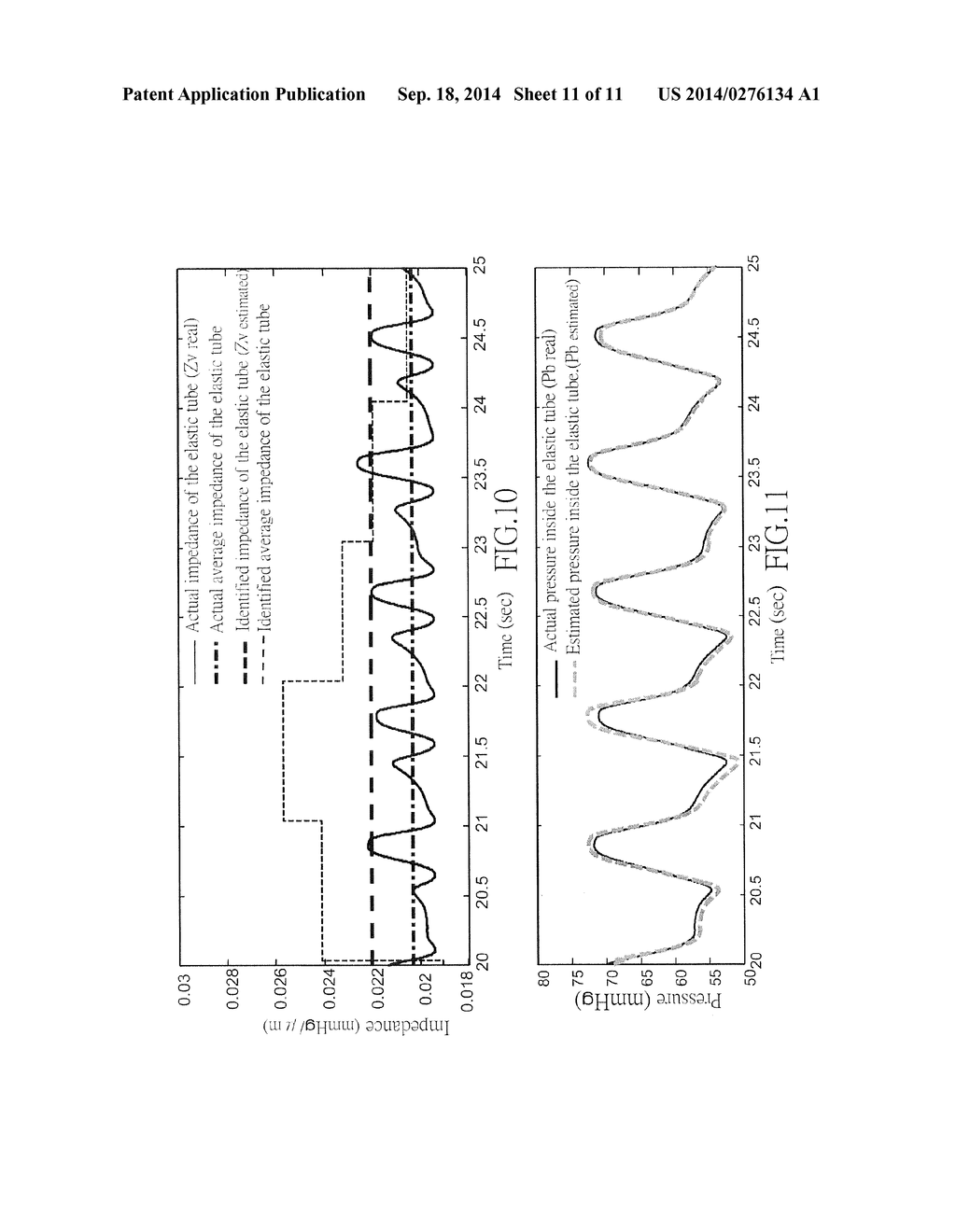 NON-INVASIVE METHOD AND DEVICE OF MEASURING THE REAL-TIME CONTINUOUS     PRESSURE OF FLUID IN ELASTIC TUBE AND THE DYNAMIC COMPLIANCE OF ELASTIC     TUBE - diagram, schematic, and image 12