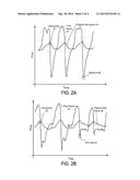 DETECTING MOUTH-BREATHING IN EARLY PHASE EXPIRATION diagram and image