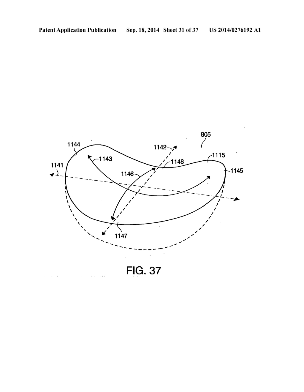 WEARABLE BODY MONITOR DEVICE WITH A PROCESSING UNIT OPERABLE TO TELL TIME - diagram, schematic, and image 32