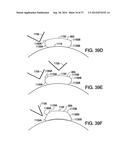 WEARABLE BODY MONITOR DEVICE WITH A PROCESSING UNIT OPERABLE TO TELL TIME diagram and image