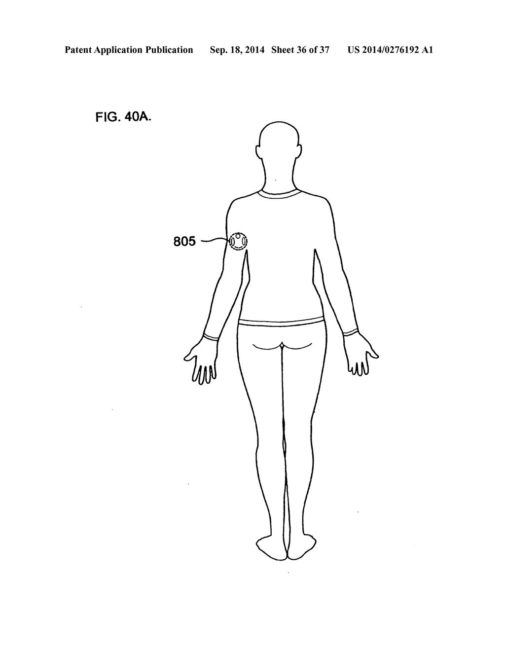 WEARABLE BODY MONITOR DEVICE WITH A PROCESSING UNIT OPERABLE TO TELL TIME - diagram, schematic, and image 37