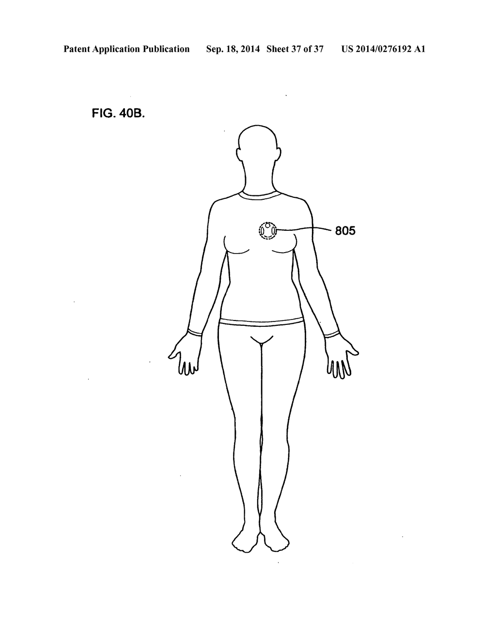 WEARABLE BODY MONITOR DEVICE WITH A PROCESSING UNIT OPERABLE TO TELL TIME - diagram, schematic, and image 38