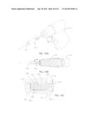 Intraosseous Device Couplers, Drivers, Kits, and Methods diagram and image