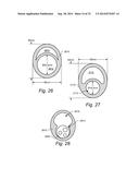 METHOD AND APPARTUS FOR HYSTEROSCOPY AND ENDOMETRIAL BIOPSY diagram and image