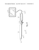 METHOD AND APPARTUS FOR HYSTEROSCOPY AND ENDOMETRIAL BIOPSY diagram and image