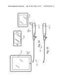 METHOD AND APPARTUS FOR HYSTEROSCOPY AND ENDOMETRIAL BIOPSY diagram and image