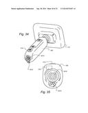 METHOD AND APPARTUS FOR HYSTEROSCOPY AND ENDOMETRIAL BIOPSY diagram and image