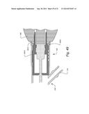 METHOD AND APPARTUS FOR HYSTEROSCOPY AND ENDOMETRIAL BIOPSY diagram and image