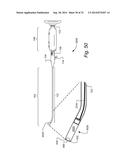 METHOD AND APPARTUS FOR HYSTEROSCOPY AND ENDOMETRIAL BIOPSY diagram and image