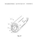 METHOD AND APPARTUS FOR HYSTEROSCOPY AND ENDOMETRIAL BIOPSY diagram and image