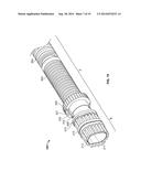 Graft Cartilage Management Systems and Methods diagram and image