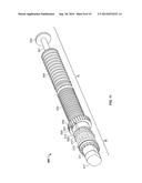 Graft Cartilage Management Systems and Methods diagram and image