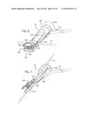 CATHETER FORCE MEASUREMENT APPARATUS AND METHOD diagram and image