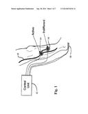 WIRELESS FOOTSWITCH AND FUNCTIONAL ELECTRICAL STIMULATION APPARATUS diagram and image