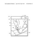 METHOD TO MEASURE MEDIAL-LATERAL OFFSET RELATIVE TO A MECHANICAL AXIS diagram and image