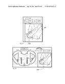 METHOD TO MEASURE MEDIAL-LATERAL OFFSET RELATIVE TO A MECHANICAL AXIS diagram and image