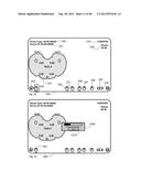 METHOD TO MEASURE MEDIAL-LATERAL OFFSET RELATIVE TO A MECHANICAL AXIS diagram and image