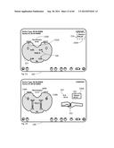 METHOD TO MEASURE MEDIAL-LATERAL OFFSET RELATIVE TO A MECHANICAL AXIS diagram and image