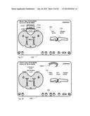 METHOD TO MEASURE MEDIAL-LATERAL OFFSET RELATIVE TO A MECHANICAL AXIS diagram and image