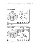 METHOD TO MEASURE MEDIAL-LATERAL OFFSET RELATIVE TO A MECHANICAL AXIS diagram and image