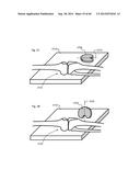 METHOD TO MEASURE MEDIAL-LATERAL OFFSET RELATIVE TO A MECHANICAL AXIS diagram and image