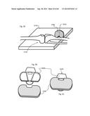 METHOD TO MEASURE MEDIAL-LATERAL OFFSET RELATIVE TO A MECHANICAL AXIS diagram and image