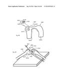 METHOD TO MEASURE MEDIAL-LATERAL OFFSET RELATIVE TO A MECHANICAL AXIS diagram and image